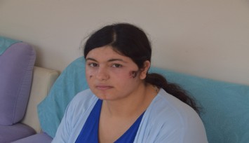 Eşini döven kocaya mahkeme: “Yaralama değil, kasten öldürmeye teşebbüs” dedi