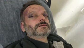 Bir müzisyene daha şarkı dayağı