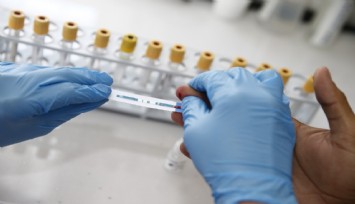 Ege’nin tek merkezinden Konak’ta ücretsiz hizmet