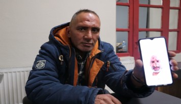 Bir sinek bu hale getirdi