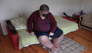 Sivrisinek, güvenlik görevlisinin hayatını kararttı