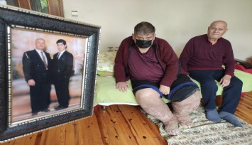 Sivrisinek ısırığı nedeniyle fil ayağı hastalığına yakalanan güvenlik görevlisi hayatını kaybetti