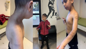 Beylikdüzü’nde özel bakım merkezinde otizmli 9 yaşındaki çocuğa şiddet iddiası