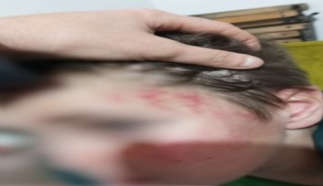 Otizmli çocuğu darbettiği iddia edilen şahsa hapis cezası