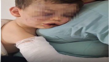 Darp sonucu hastanelik olan bebek devlet korumasına alınacak