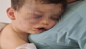 Denizli'de yürek sızlatan görüntüler: 2 yaşındaki bebek annesinin sevgilisi tarafından dövüldü