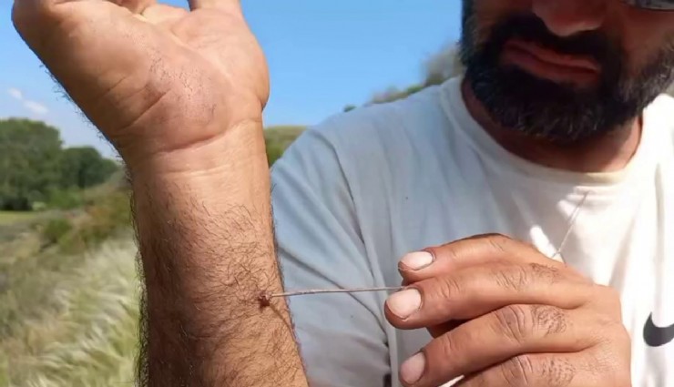 Uzmanı uyardı: 'Kenenin vücutta kalma süresi hastalığın bulaşma riskini yükseltiyor'