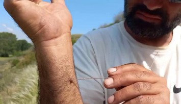 Uzmanı uyardı: 'Kenenin vücutta kalma süresi hastalığın bulaşma riskini yükseltiyor'