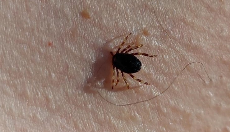 Uzmanlardan ’kene’ uyarısı: 'Belirtiler keneye has değil, hemen ortaya çıkmayabiliyor'