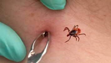 Sivas'ta kene kabusu: 2 çocuk babası hayatını kaybetti