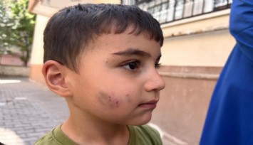 Ankara’da bir çocuk, lağım faresi tarafından ısırıldı