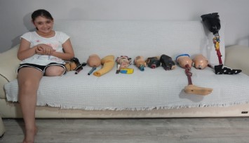 12 yaşındaki Özge, hayırsever desteğiyle hidrolik protezine kavuşuyor