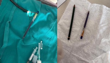 Ağrı’da genç kadının midesinden endoskopiyle iki kalem çıkarıldı