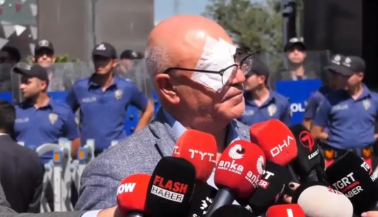 Mahmut Tanal görme kaybından kıl payı kurtuldu: 'Bu saldırı sadece CHP’ye değil, Türkiye demokrasisine yöneliktir'