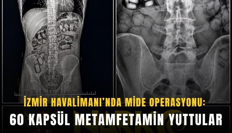 İzmir Havalimanı’nda mide operasyonu: 60 kapsül metamfetamin yuttular