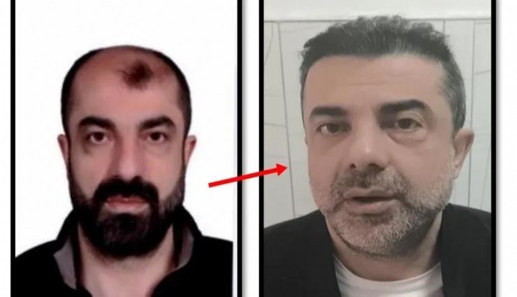 Ameliyatla yüzünü değiştiren firari cinayet zanlısı 7 yıl sonra yakalandı