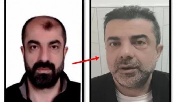 Ameliyatla yüzünü değiştiren firari cinayet zanlısı 7 yıl sonra yakalandı