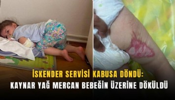 İskender servisi kabusa döndü: Kaynar yağ Mercan bebeğin üzerine döküldü
