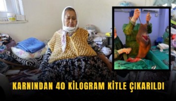 Karnından 40 kilogram kitle çıkarıldı