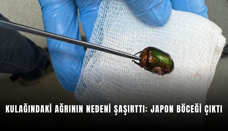 Kulağındaki ağrının nedeni şaşırttı: Japon böceği çıktı
