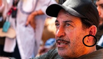 Cem Yılmaz’ın kulağındaki çizgi dikkat çekti: Kalbin habercisi mi?